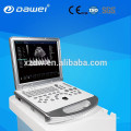 Máquina portátil do ultra-som de Doppler da cor de DW-C60PLUS para a clínica &amp; o hospital